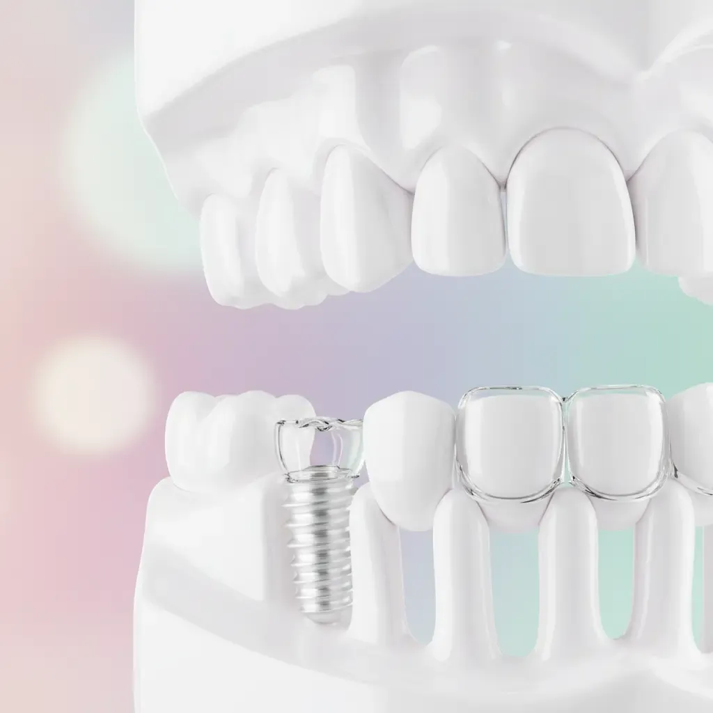 Pédodontie Bo sourire Rabat